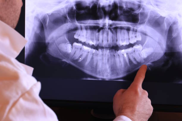 Best Emergency Dental Surgery in Cadiz, KY