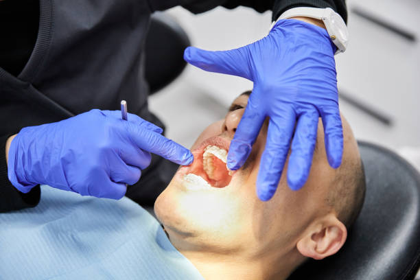 Best Emergency Tooth Extraction in Cadiz, KY