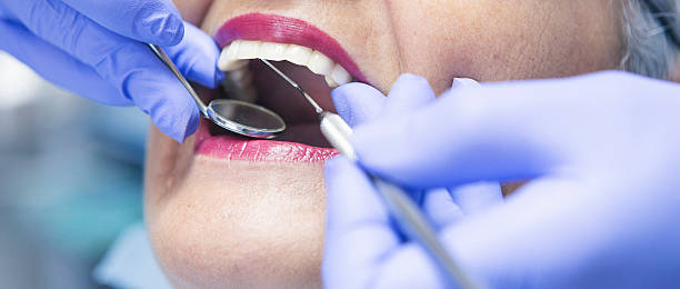 Best Emergency Broken Tooth Repair in Cadiz, KY